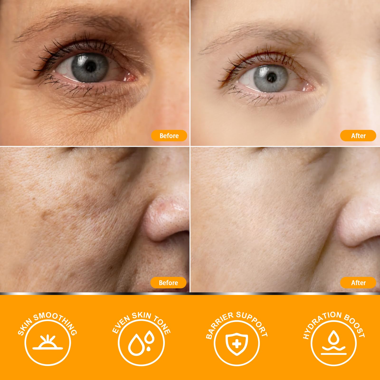 "Resultados del sérum de Vitamina C para arrugas y manchas"